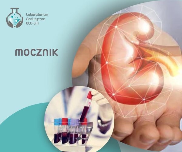 Badania laboratoryjne w pigułce. Mocznik. Laboratorium Analityczne BCO