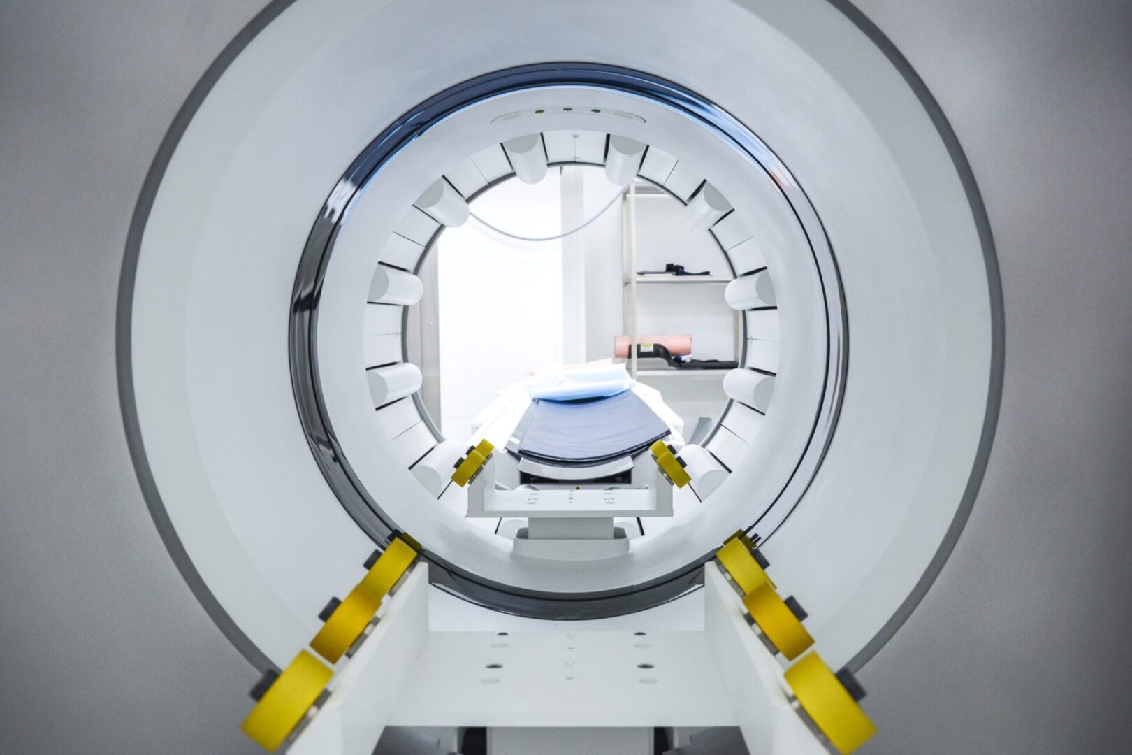 Leczenie nadczynności tarczycy z wykorzystaniem radiofarmaceutyków