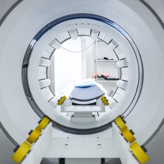 Leczenie nadczynności tarczycy z wykorzystaniem radiofarmaceutyków