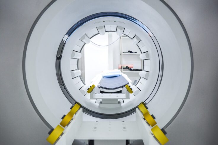 Leczenie nadczynności tarczycy z wykorzystaniem radiofarmaceutyków